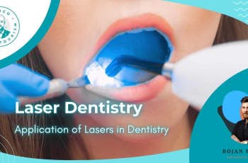 Laser Dentistry: Application of Lasers in Dentistry marco dental tourism