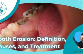 Tooth Erosion: Definition, Causes, and Treatment marco dental tourism