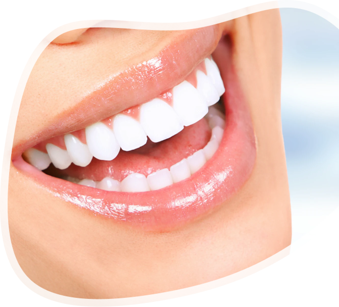 Osoba izbliza Pre i Posle nakon Hollywood smile estetičke stomatološke usluge - holivudski osmeh za blistav osmeh